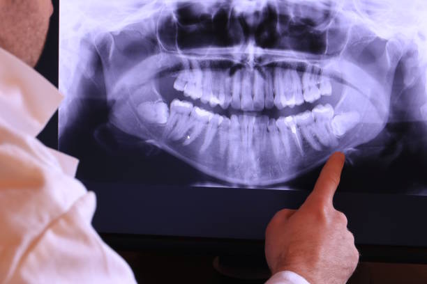 Best Tooth Infection Emergency Dentist  in Franklin, TX