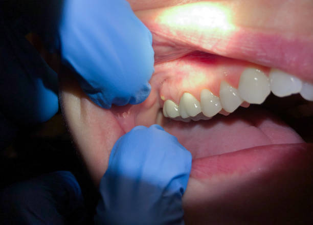 Best Broken Tooth Emergency  in Franklin, TX
